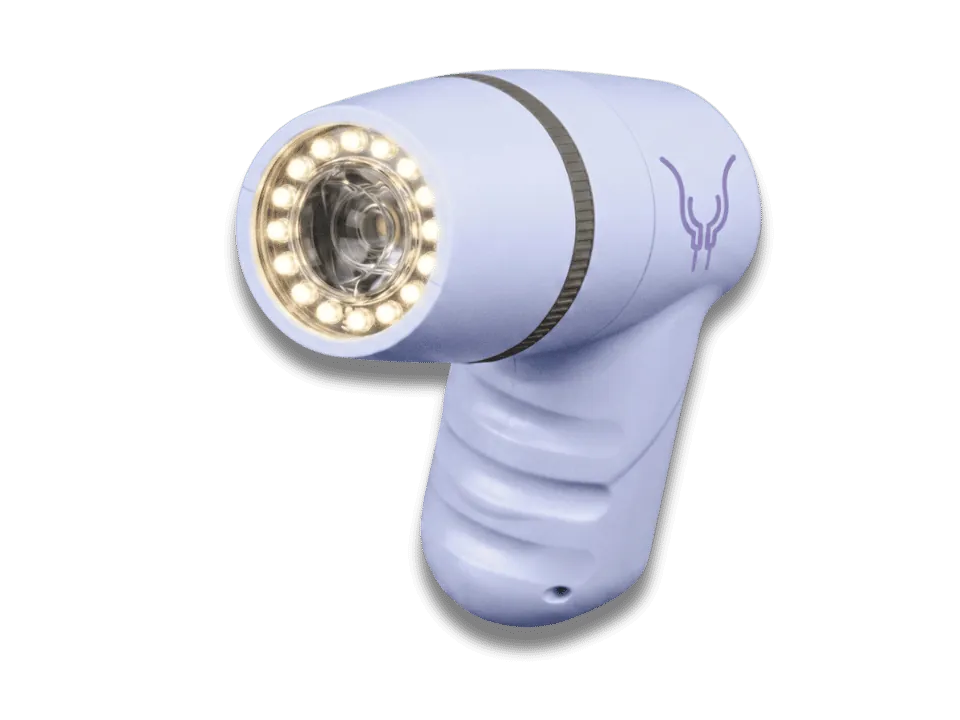 Griva Vision portable digital colposcope device optimized for mobile cervical screening in hospital clinics